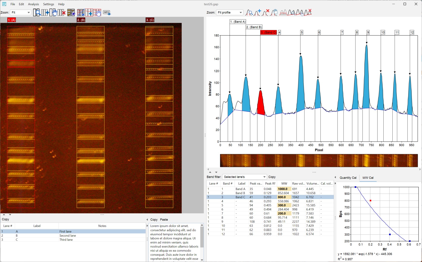 GelAnalyzer 26.1 main user interface